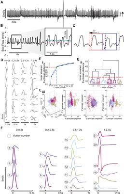 Automated Classification of Whole Body Plethysmography Waveforms to Quantify Breathing Patterns